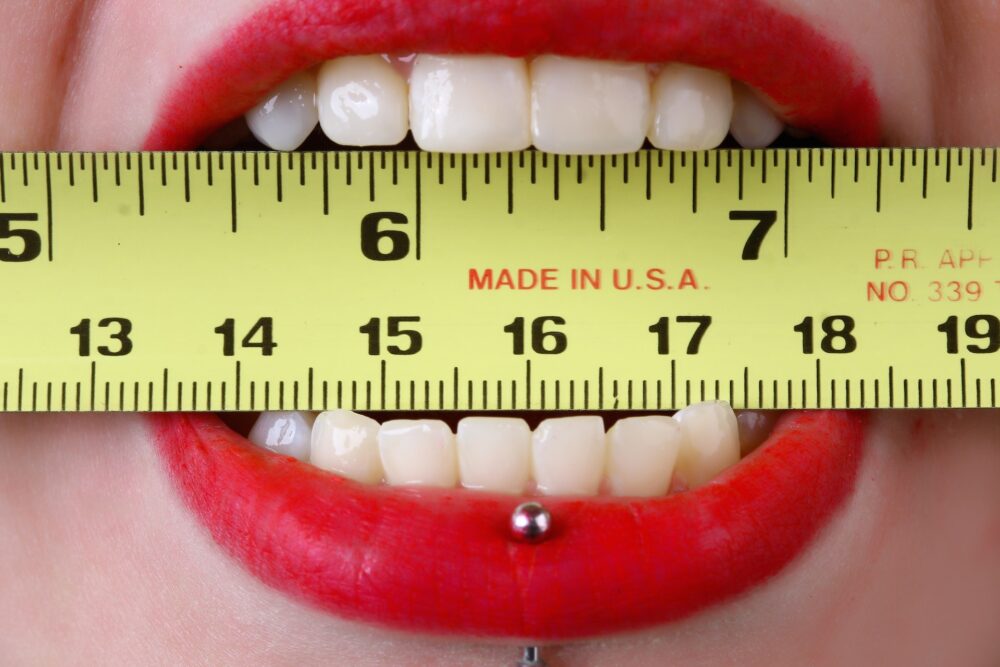 the yellow tape measure measures the gap between the teeth